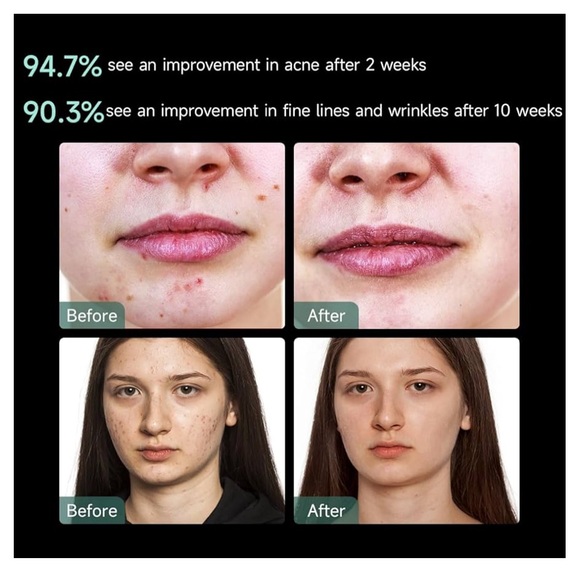 Moonlight LED Facial Mask - Picture 3 of 4